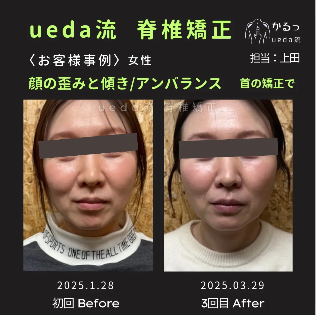 顔全体のバランスに注目!お肌の透明感まで✨|整体|高砂市|播州エリア