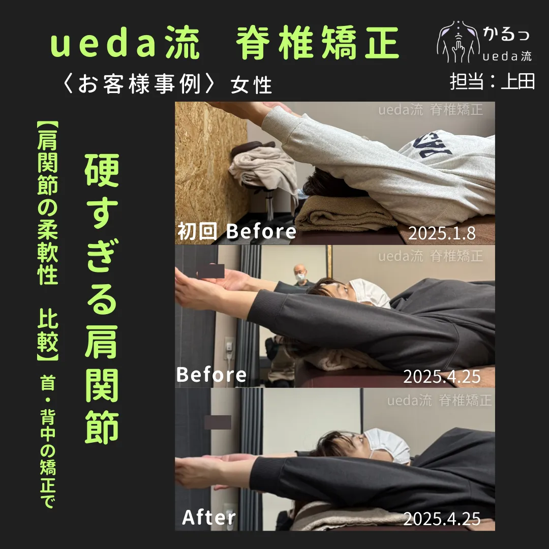 肩の柔軟性に注目!|整体|高砂市|播州エリア