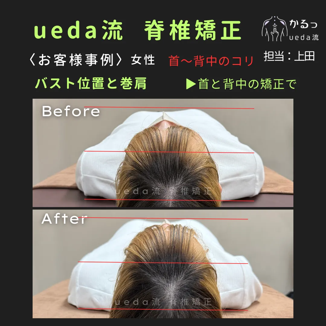 首と背中の矯正でバストラインが整う?|整体|高砂|播州エリア